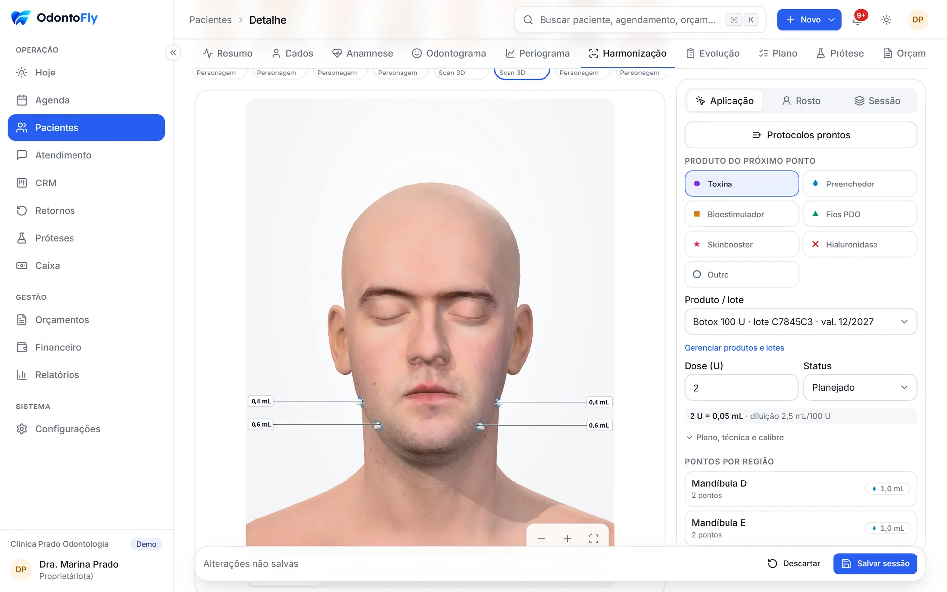 Harmonização orofacial com rosto 3D, pontos de aplicação e doses