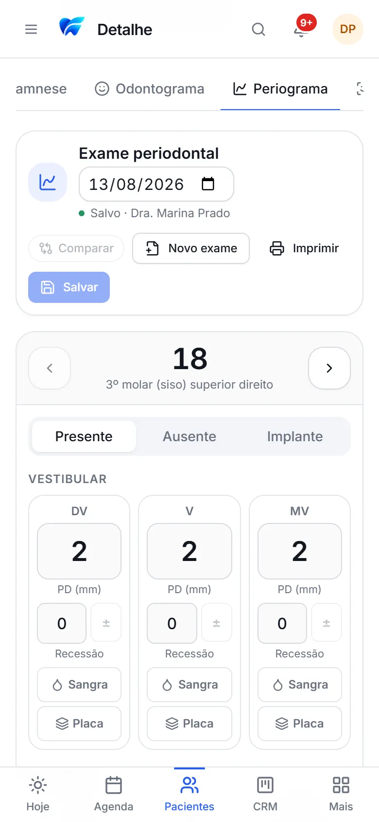 Periograma no celular